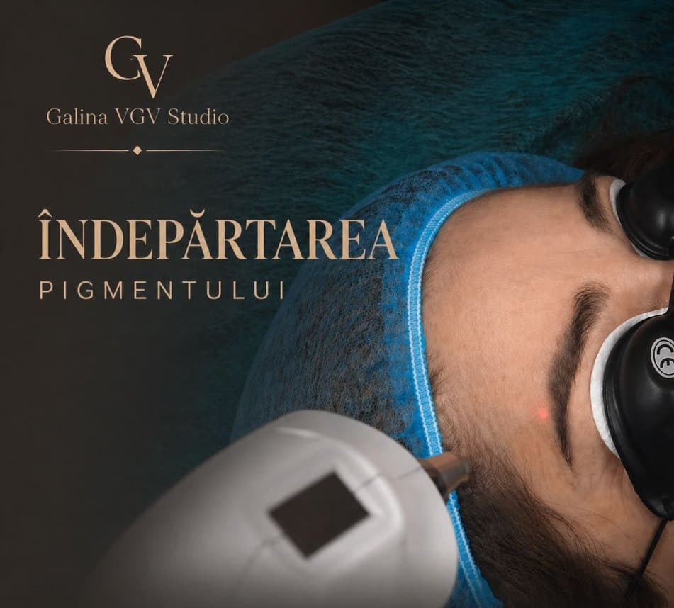 Îndepărtare laser pigment permanent, Galina VGV Studio Medgidia